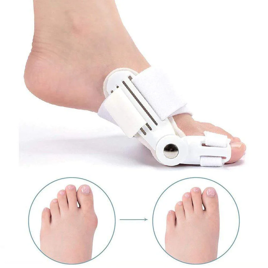 Corrective Bunion Splint (1 Pair) – BunionFix - Image 2