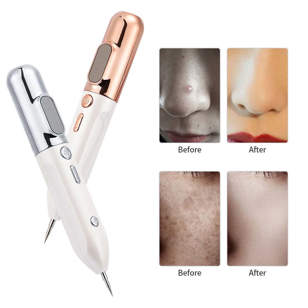 Plasma Skin Rejuvenation Pen - GlowLift - Image 4